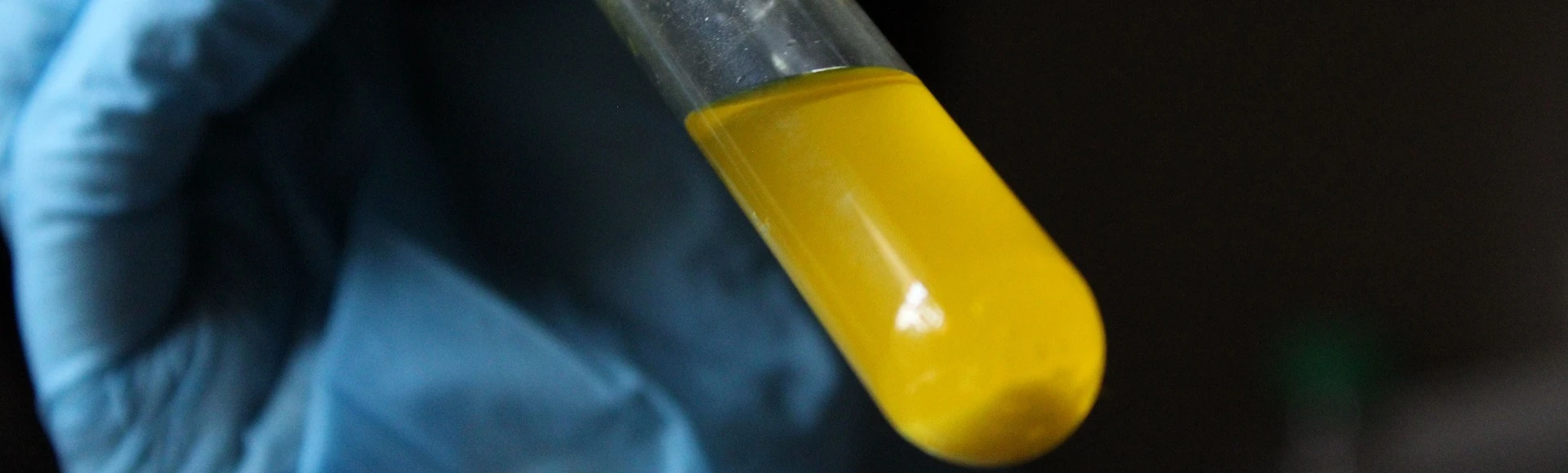 Preparaty wspierające zdrowie układu moczowego i pojemniki na mocz niezbędne do wykonania badań laboratoryjnych dostępne są w aptece internetowej Centralna.pl