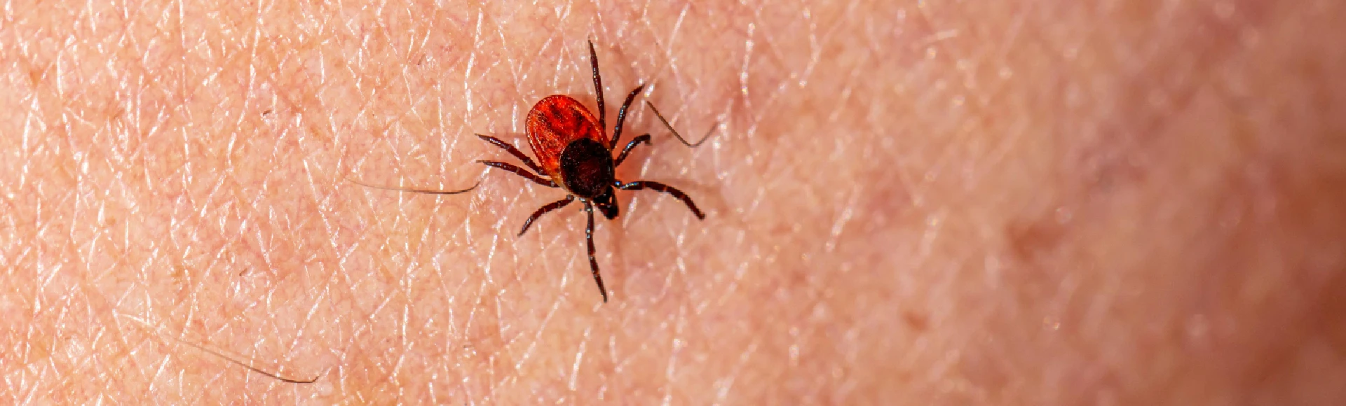 Rumień wokół miejsca ugryzienia kleszcza może świadczyć o zarażeniu boreliozą. Skuteczne preparaty na kleszcze i narzędzia do usuwania kleszczy znajdziesz w Aptece Centralnej.