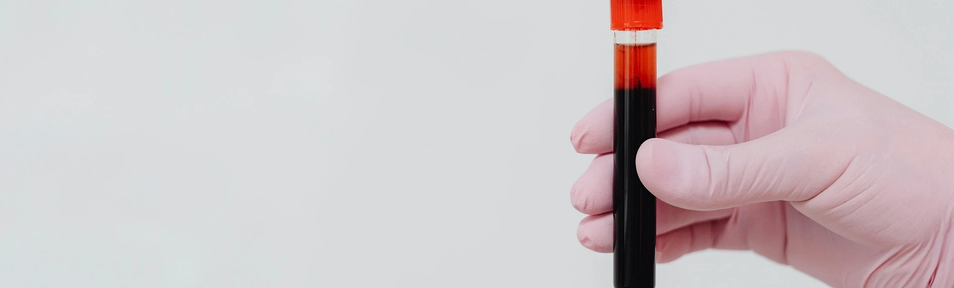 Antyoksydanty chroniące tkanki przed stresem oksydacyjnym wywołanym nadmiarem żelaza znajdziesz w aptece internetowej Centralna.pl