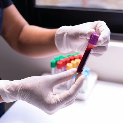 Hiperinsulinemia – co powoduje i jak objawia się wysoki poziom insuliny?