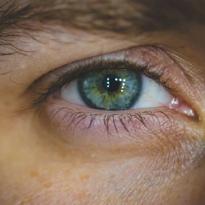 Jęczmień na oku – przyczyny, objawy, leczenie