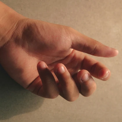 Obgryzanie paznokci – przyczyny, skutki i sposoby na sposoby na onychofagię