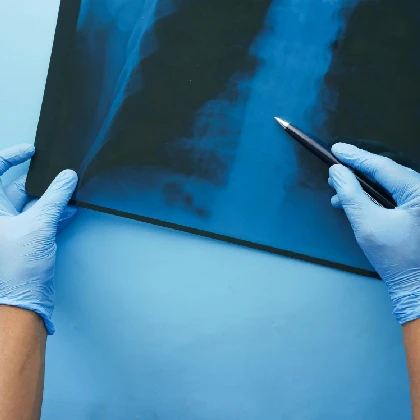 Obturacyjna choroba płuc – przyczyny, objawy, leczenie