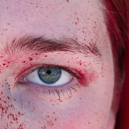 Odra choroba zakaźna wieku dziecięcego – objawy, sposoby leczenia i profilaktyka