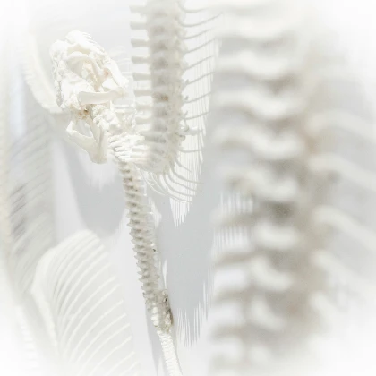 Osteoporoza – co to, jakie są przyczyny, objawy i sposoby leczenia osteoporozy?