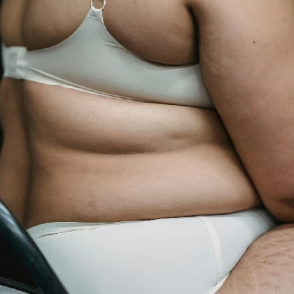 Otyłość – objawy, rodzaje otyłości i sposoby leczenia