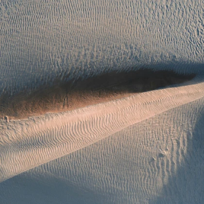 Rozstępy – jak wyglądają, czemu powstają i jak się ich pozbyć? Rozstępy – jak wyglądają, czemu powstają i jak się ich pozbyć?