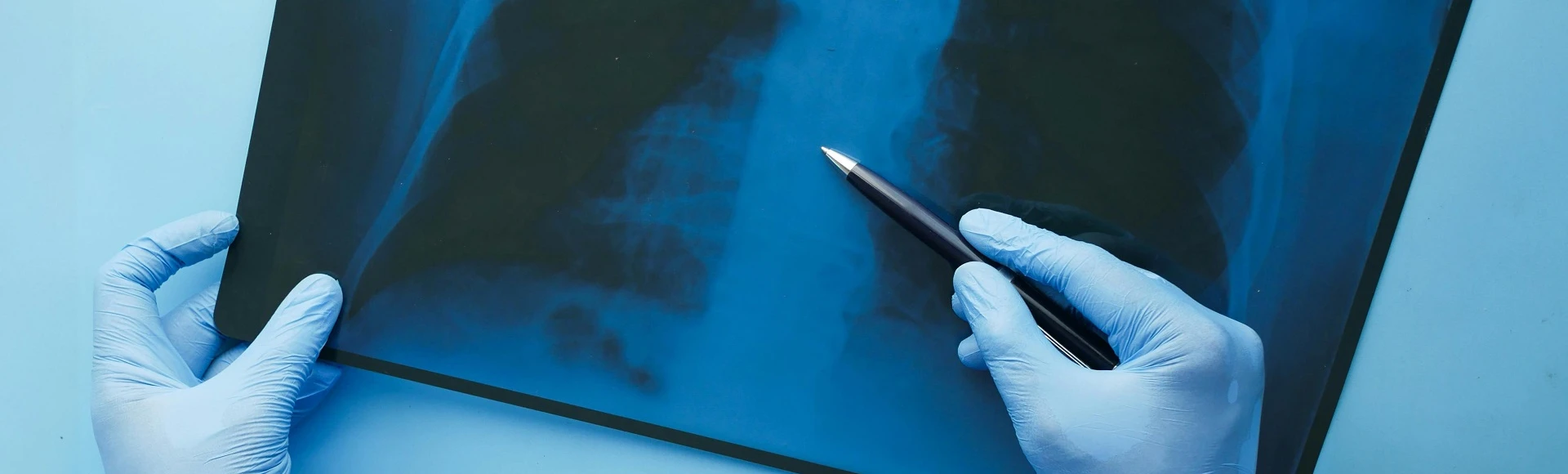 Palenie jako przyczyna POChP