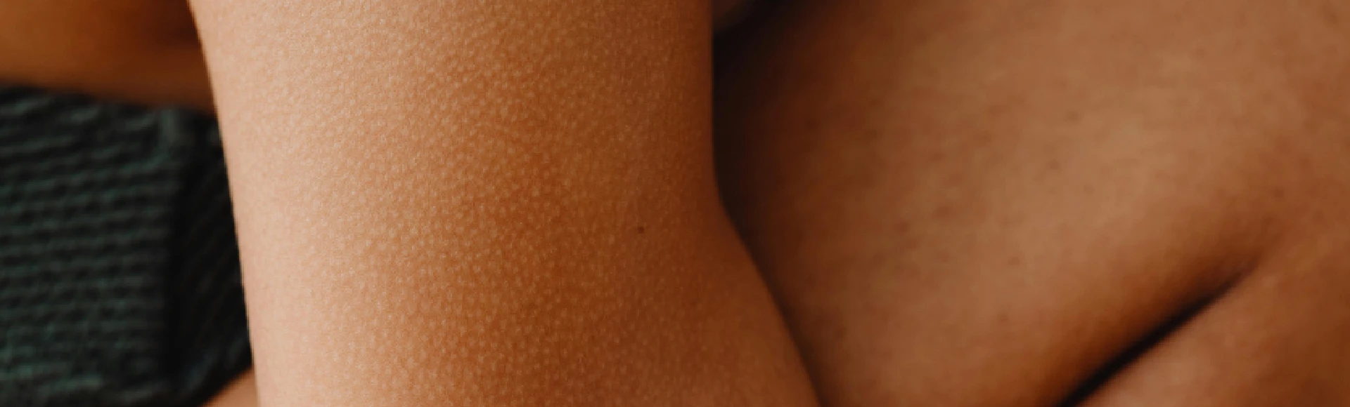 Brak regularnego złuszczania i nawilżenia skóry może być przyczyną rogowacenia okołomieszkowego. Łagodne emolienty i wygładzające peelingi znajdziesz w internetowej Aptece Centralnej. Brak regularnego złuszczania i nawilżenia skóry może być przyczyną rogowacenia okołomieszkowego. Łagodne emolienty i wygładzające peelingi znajdziesz w internetowej Aptece Centralnej.