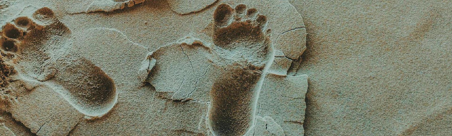 Leczenie stopy cukrzycowej opiera się głównie na opatrywaniu istniejących ran. Produkty do dezynfekcji i opatrywania ran znajdziesz w internetowej aptece Centralna.pl