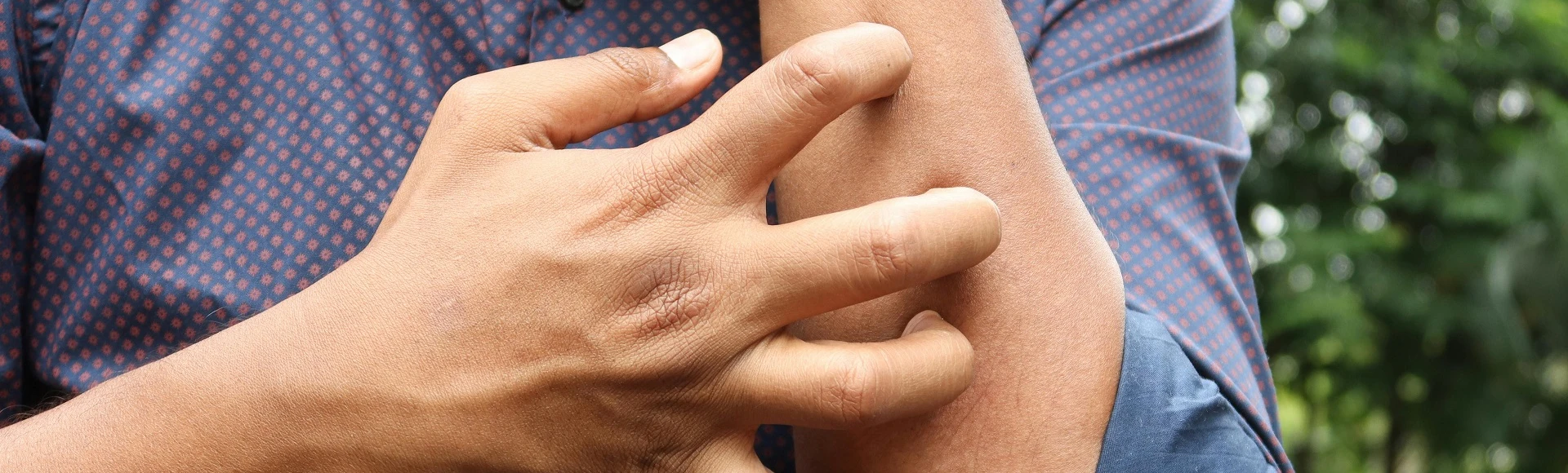 Maści i kremy na świąd skóry oraz dostępne bez recepty leki przeciwhistaminowe na alergie skórne znajdziesz w aptece internetowej Centralna.pl