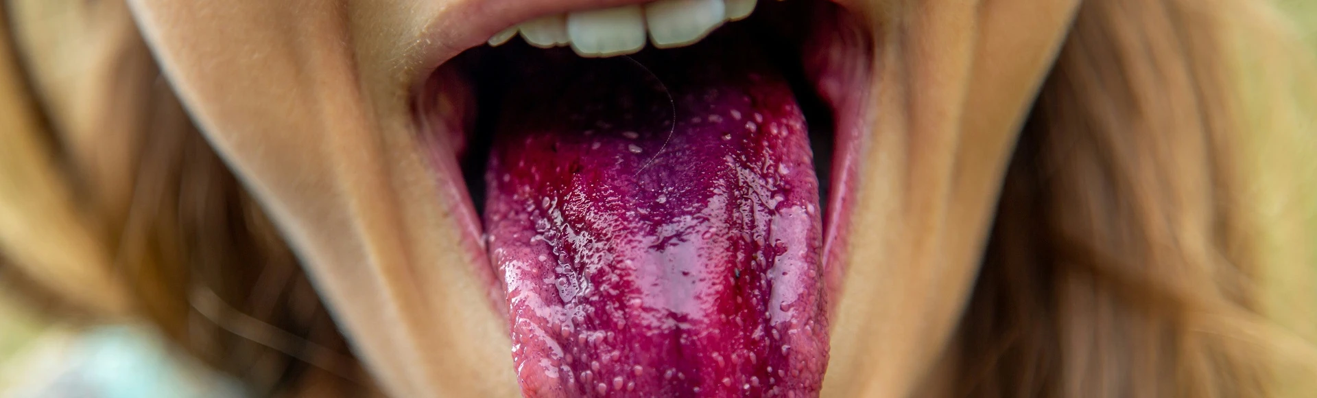 Leki przeciwgorączkowe i przeciwbólowe łagodzące objawy szkarlatyny znajdziesz w aptece internetowej Centralna.pl