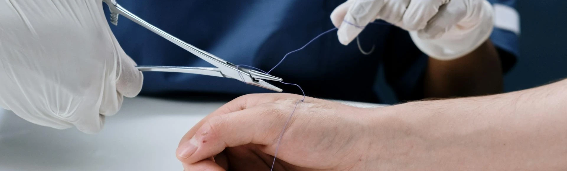 Leczenie tłuszczaków zazwyczaj wymaga interwencji chirurgicznej. Maści i żele na bliznę po usunięciu tłuszczaka znajdziesz w internetowej aptece Centralna.pl Leczenie tłuszczaków zazwyczaj wymaga interwencji chirurgicznej. Maści i żele na bliznę po usunięciu tłuszczaka znajdziesz w internetowej aptece Centralna.pl