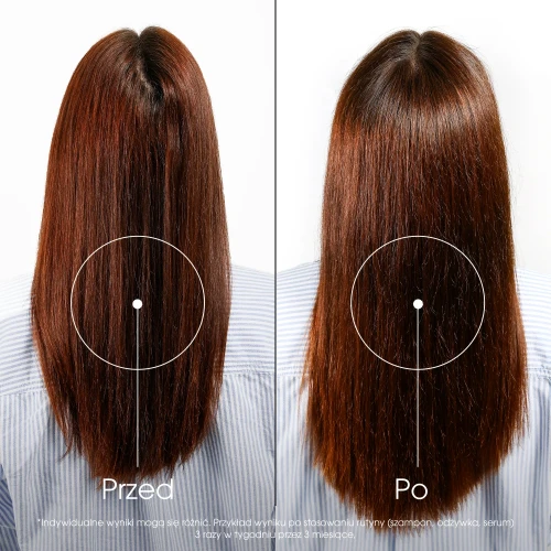 Klorane Chinina, Szarotka, odżywka wzmacniająca, 200 ml - Przeciw wypadaniu włosów - 4