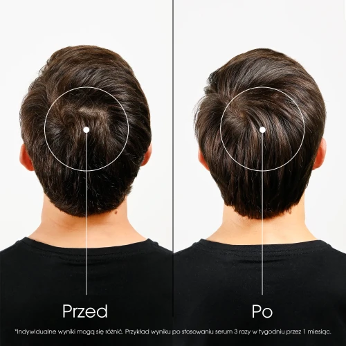 Klorane  Chinina, kuracja przeciw wypadaniu włosów, 100 ml - Intensywne serum wzmacniające z chininą i kofeiną - 8