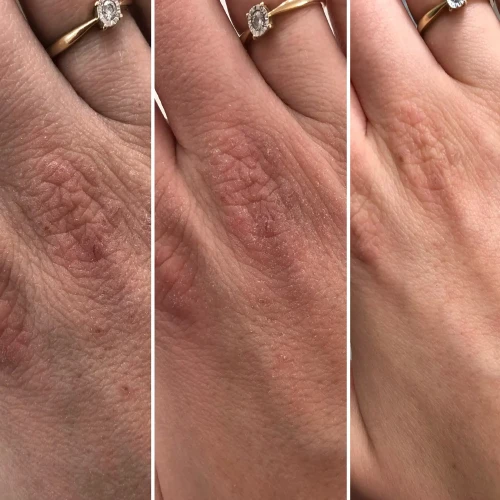 Swederm Hudsalva Sensitive, maść do skóry suchej i atopowej, 50 ml - Regeneruje i koi podrażnienia - 2