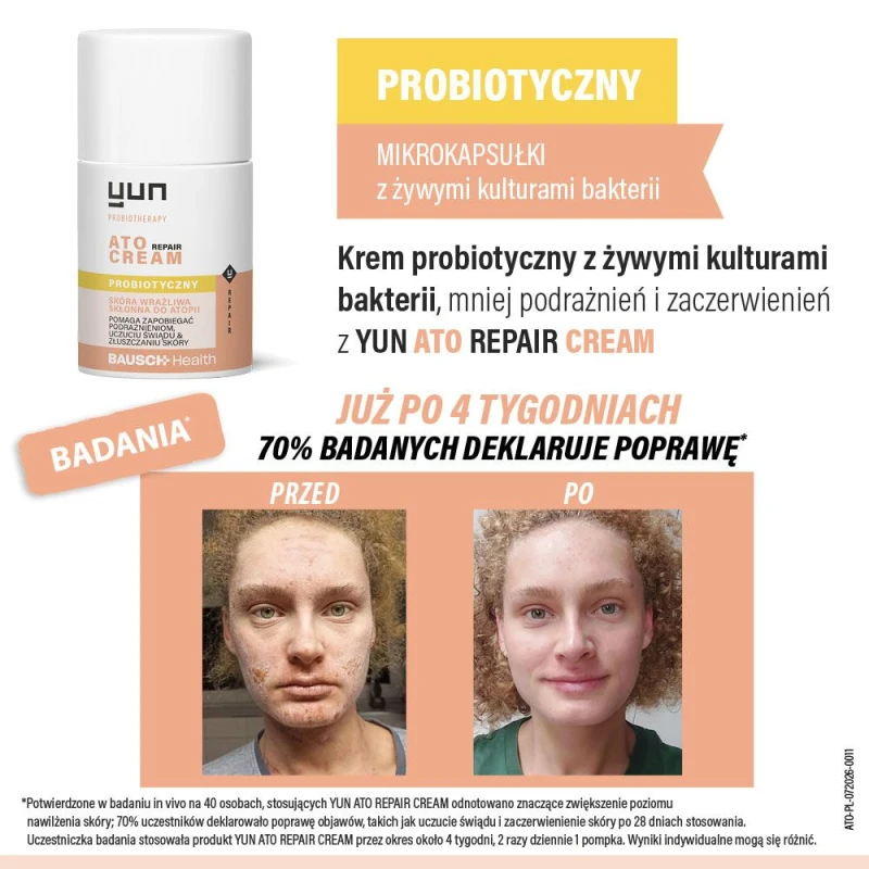 Yun ATO Repair Cream Krem probiotyczny, 50 ml - Do skóry suchej, wrażliwej i skłonnej do atopii - 3