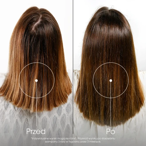 Klorane Chinina, Szarotka, szampon przeciw wypadaniu włosów, 200 ml - Stymulująca pielęgnacja osłabionych włosów - 2