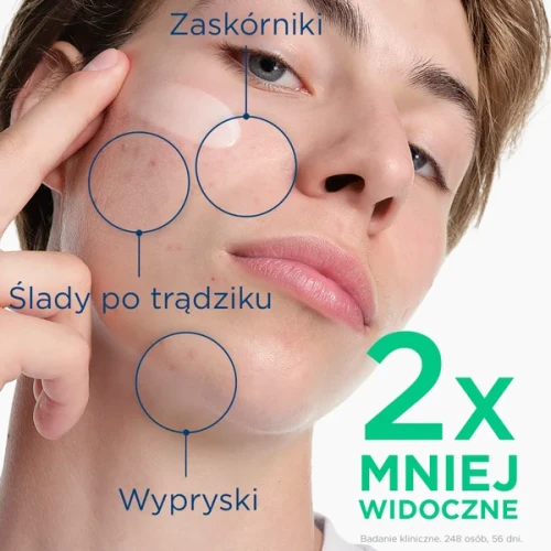 Bioderma Sebium Kerato+, żel-krem przeciw niedoskonałościom, 30 ml - Redukuje wypryski i zaskórniki jednocześnie stymulując odnowę naskórka - 2