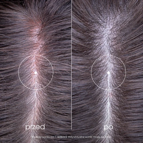 Klorane Piwonia, szampon przeciw podrażnieniom, 400 ml - Do wszystkich rodzajów włosów oczyszcza, chroni i łagodzi wrażliwą skórę głowy - 2