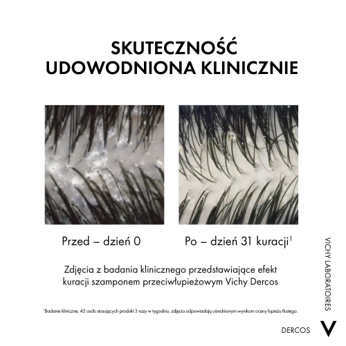 Vichy Dercos DS, szampon przeciwłupieżowy z odżywką 2 w 1, 390 ml - Pelęgnuje włosy i usuwa łupież  - 4